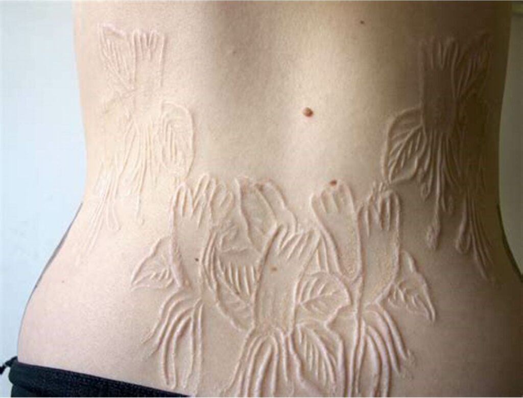 Tatuajes por Escarificación: Técnicas y Cuidados 1 Tatuajes por Escarificación: Técnicas y Cuidados 1