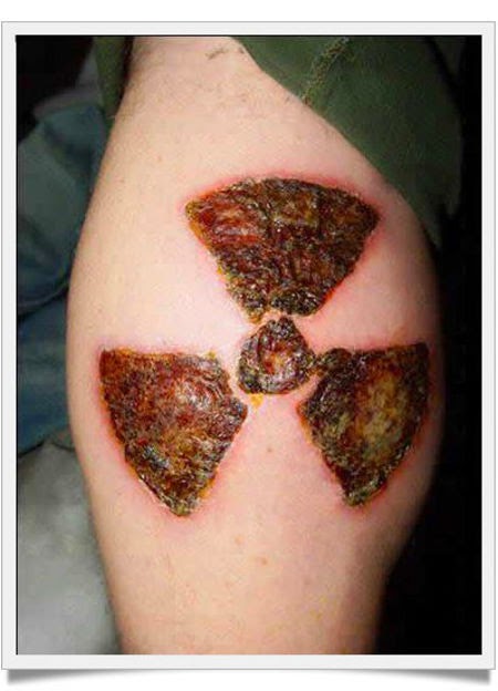 Escarificación: los tatuajes cicatrices 8