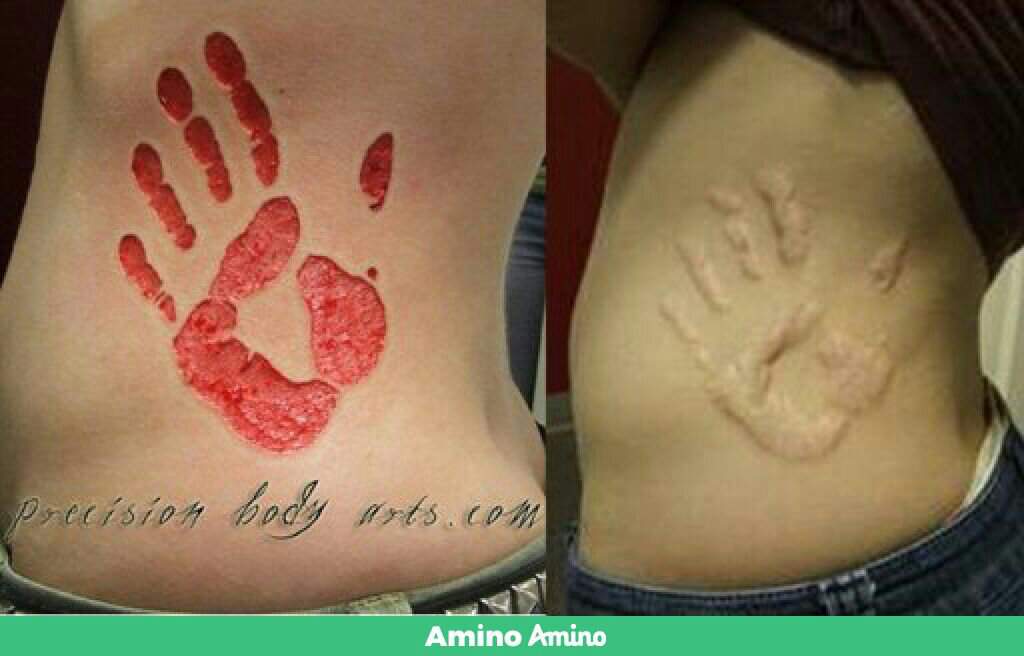 Tatuajes por Escarificación: Técnicas y Cuidados 20 Tatuajes por Escarificación: Técnicas y Cuidados 20