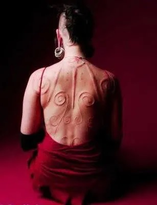 Escarificación: los tatuajes cicatrices 10