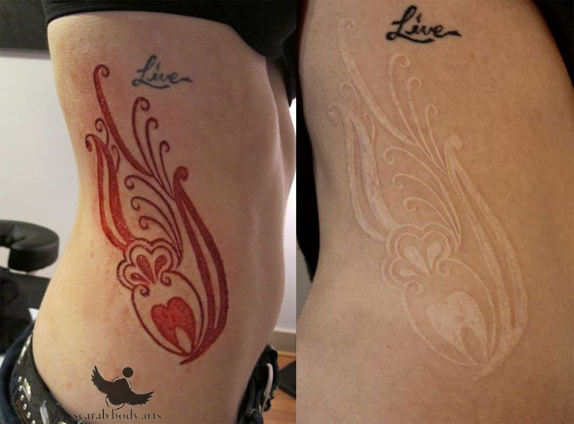 Escarificación: los tatuajes cicatrices 13